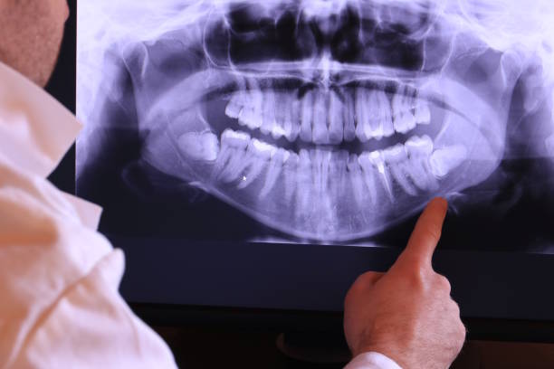 Best Emergency Dental Care for Abscessed Tooth in Gorman, TX