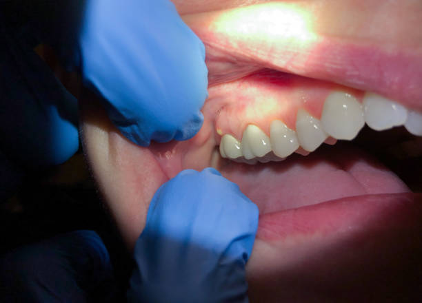 Best Emergency Dentist for Special Needs Patients in Gorman, TX