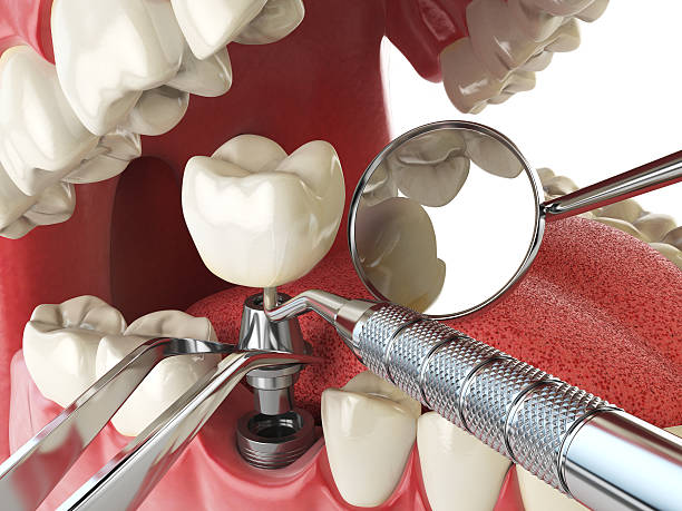 Best Emergency Dental Extractions in Gorman, TX